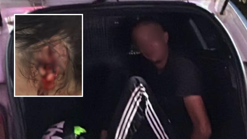Mulher tem orelha arrancada após ser mordida por marido em ataque de ciúmes em MT, diz polícia