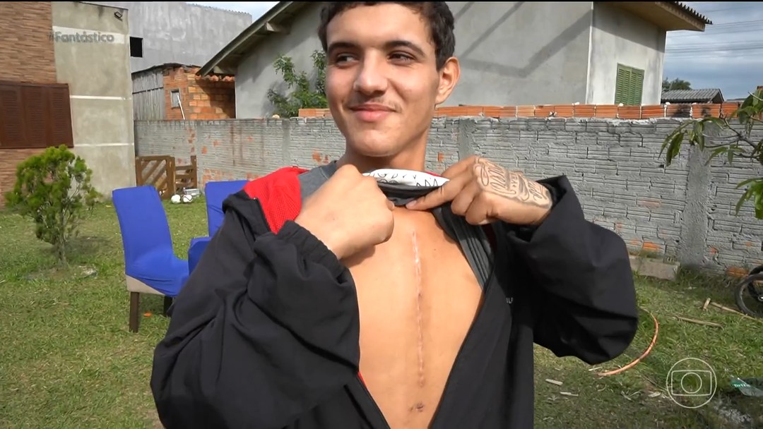 Jovem sobrevive à cirurgia para retirar prego cravado no coração: 'Nasci de novo'