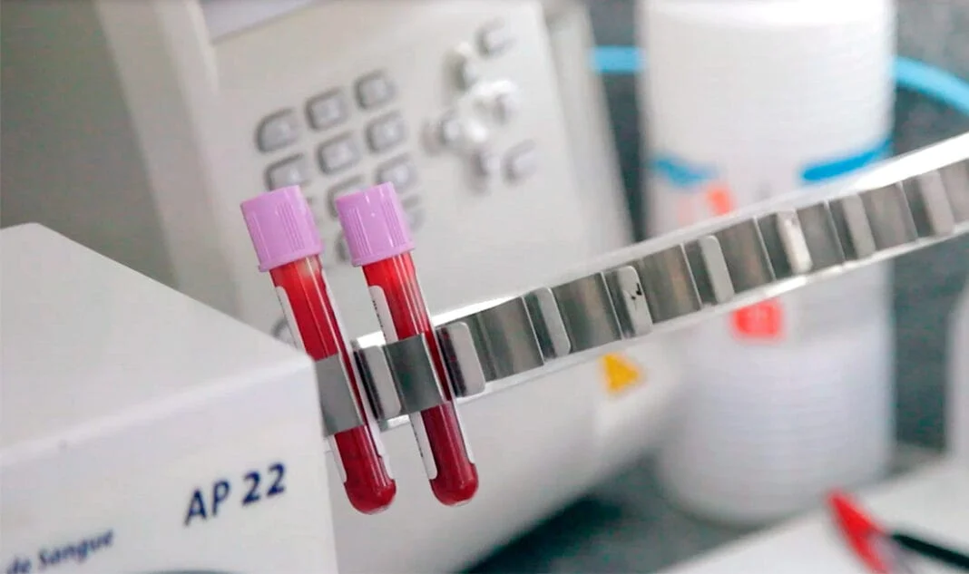Sorriso tem 51 novos casos de HIV no ano; nove em gestantes