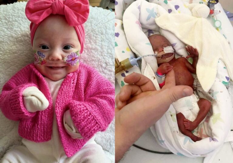 Bebê que nasceu de 22 semanas com 500 gramas tem alta do hospital e vai para casa